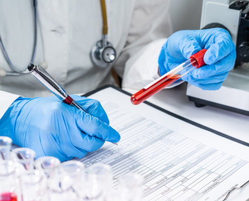 Medical Professional Looking At Blood Test